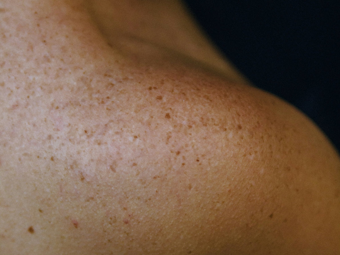 Cea mai bună cremă pentru pete pigmentare ghid complet și recomandări de la un brand românesc de skincare