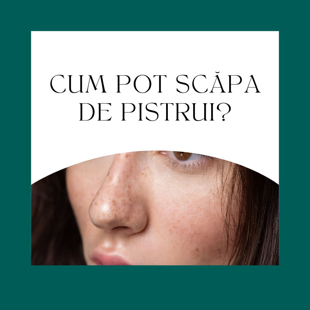 Cum pot scăpa de pistrui?