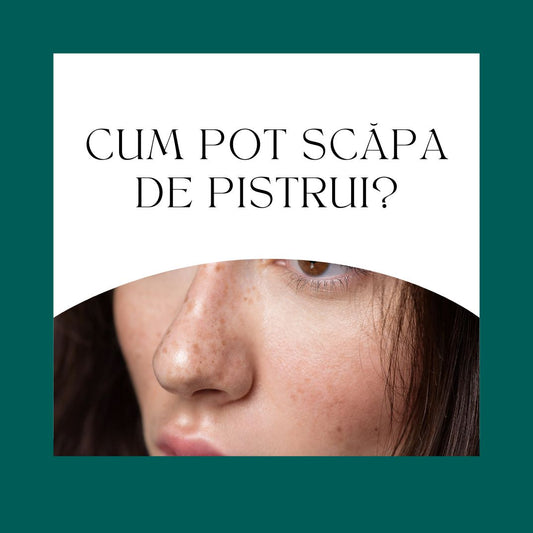 Cum pot scăpa de pistrui?