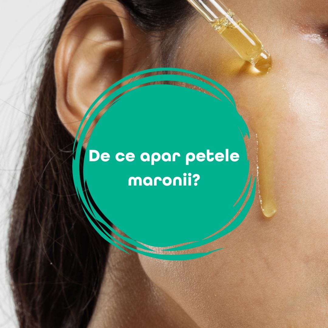 De ce apar petele maronii