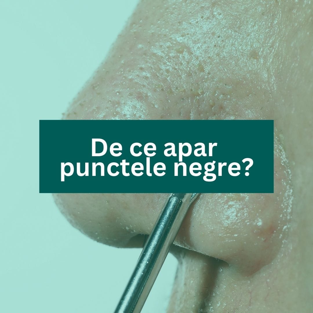 De ce apar punctele negre?