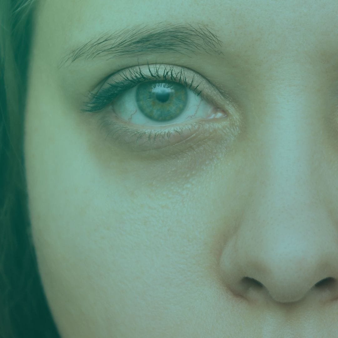 Vreau să scap de cearcăne rapid – Sfaturi și soluții eficiente