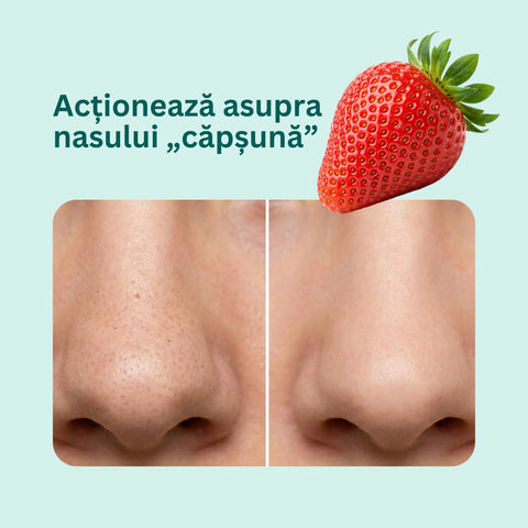 Exfoliant facial MicroDerm, 50 ml